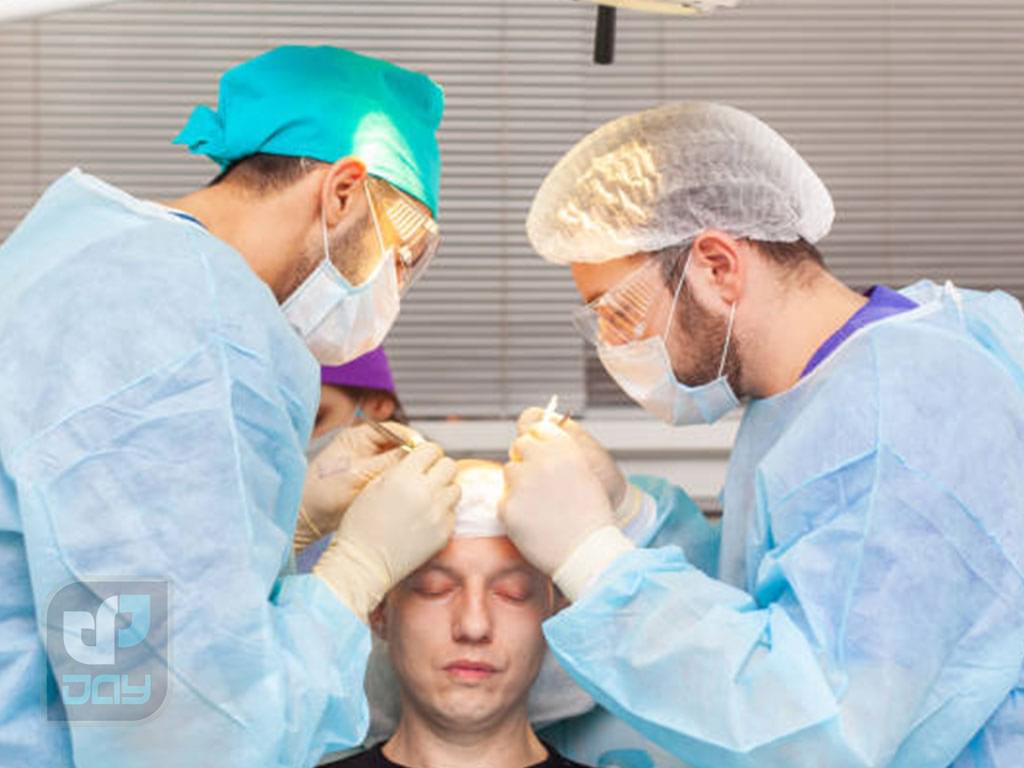 کاشت مو برای چه کسانی مناسب است؟ 3 کاشت مو برای چه کسانی مناسب است-1