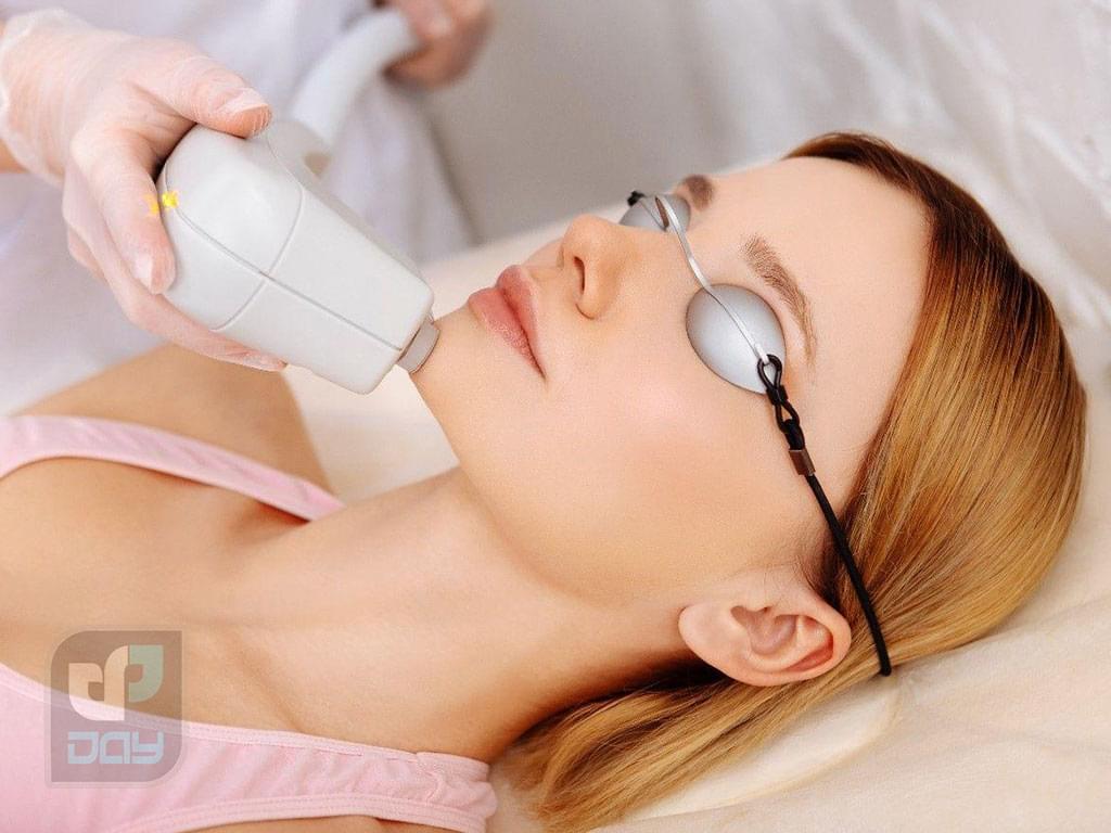 لیزر موهای زائد در شیراز | قیمت، مزایا، مراقبتها 4 لیزر موهای زائد در شیراز-3
