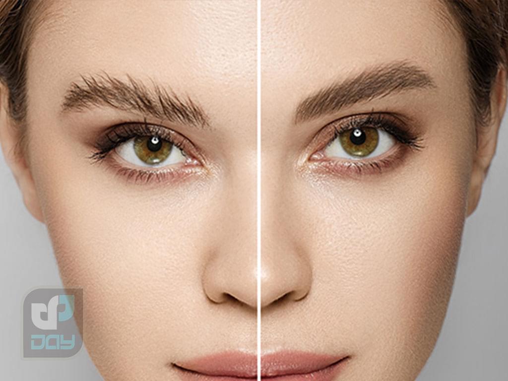 کاشت ابرو چیست و چگونه انجام میشود؟ 2 کاشت ابرو-1