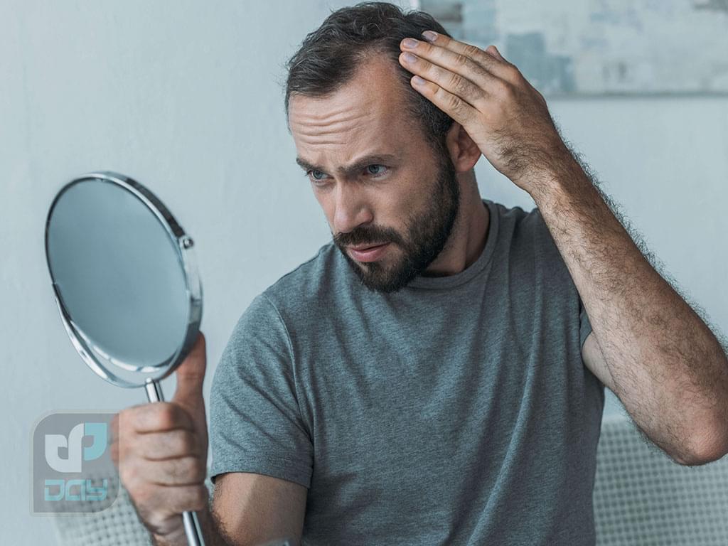 کاشت مو برای چه کسانی مناسب است؟ 2 مو برای چه کسانی مناسب است؟