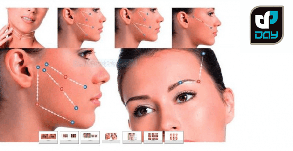 لیفت صورت با تکنیک نخ 1 لیفت صورت با تکنیک نخ