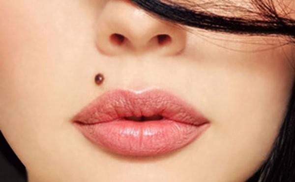 برداشتن خال و ضایعات گوشتی 1 برداشتن خال و ضایعات گوشتی