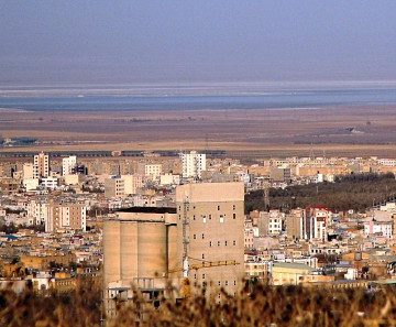 کاشت مو در اراک