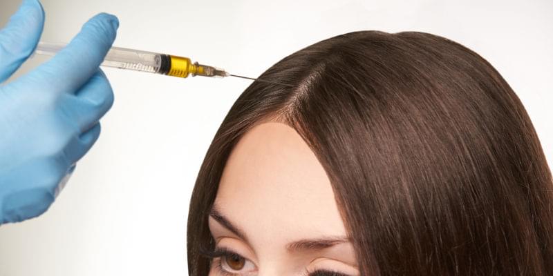 مزوتراپی 1 1611486067