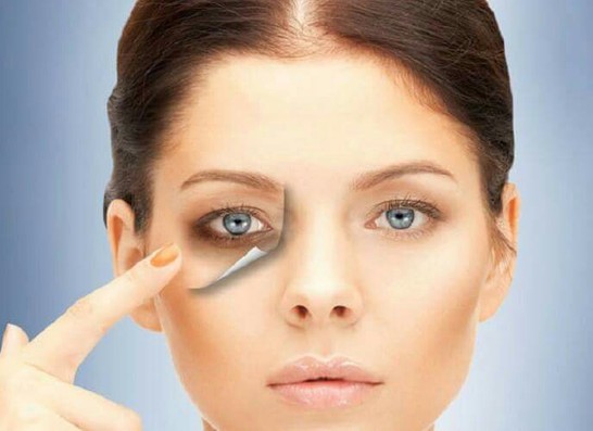 کربوکسی تراپی، ساده ترین راه جوانسازی پوست 5 کربوکسی تراپی موثر در از بین بردن حلقه های تیره زیر چشم