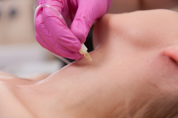 کربوکسی تراپی، ساده ترین راه جوانسازی پوست 1 Carboxytherapy