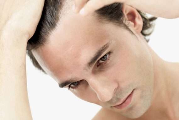 نکات کاشت مو