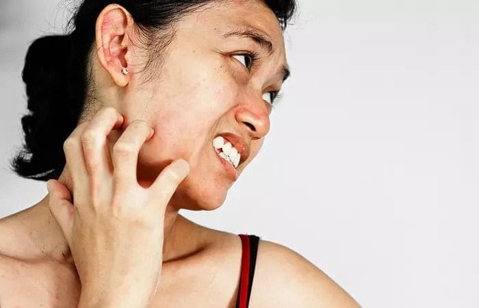 مزوتراپی صورت چیست و چه مزایایی دارد 4 عوارض جانبی مزوتراپی صورت