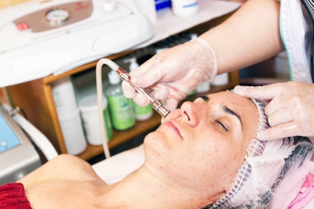 با کاربردها و مزایای میکرونیدلینگ آشنا شوید 3 میکرونیدلینگ جای اسکارها را از بین می برد