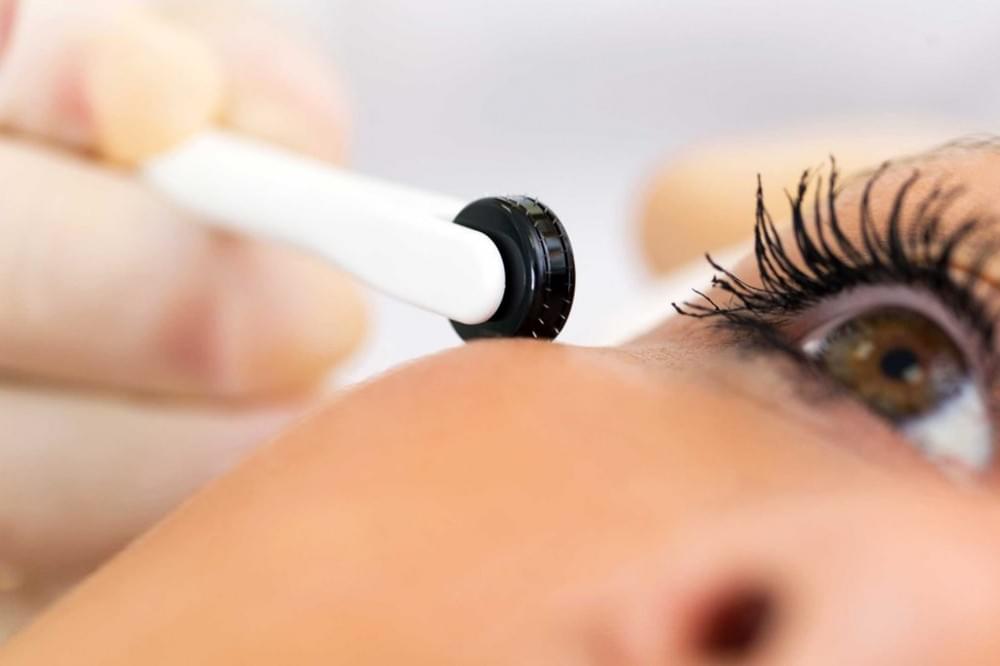 با کاربردها و مزایای میکرونیدلینگ آشنا شوید 4 میکرونیلینگ آسیب های ناشی از خورشید و پیگمنتیشن را از بین می برد