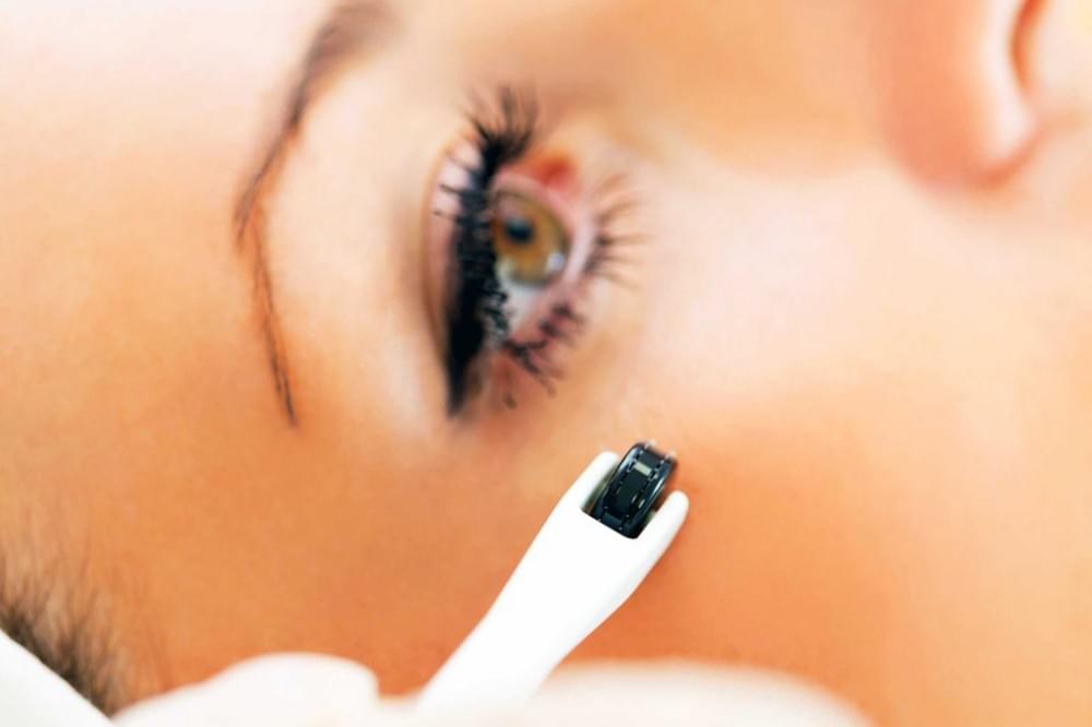 با کاربردها و مزایای میکرونیدلینگ آشنا شوید 6 میکرونیدلینگ منافذ پوست را کوچک می کند.