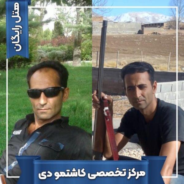 کاشت مو 29 1699168055 600x600