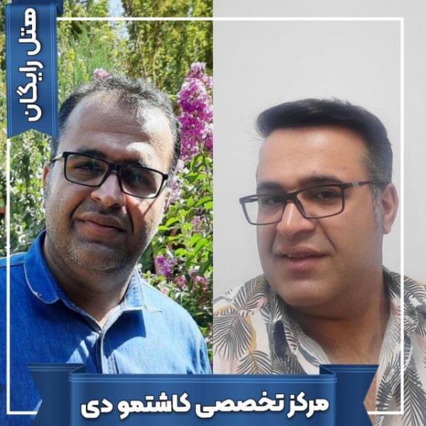 کاشت مو 34 1699168073 600x600