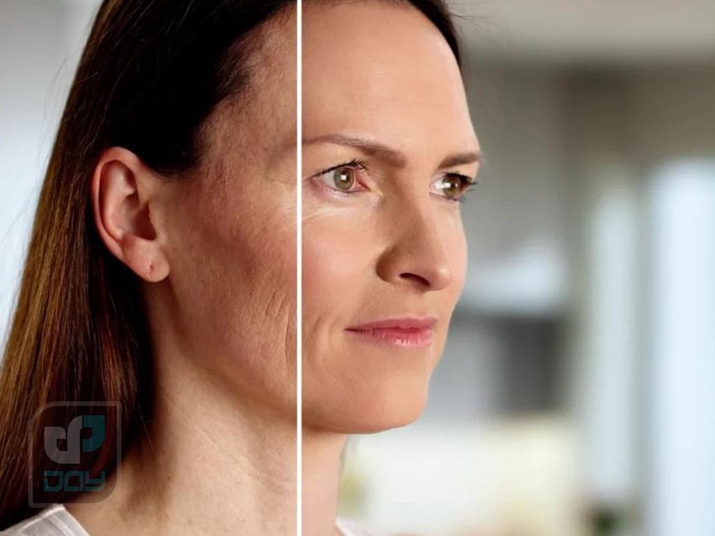 لیزر پیکو چیست؟ کاربردها، مزایا، عوارض 3 لیزر پیکوشور-2