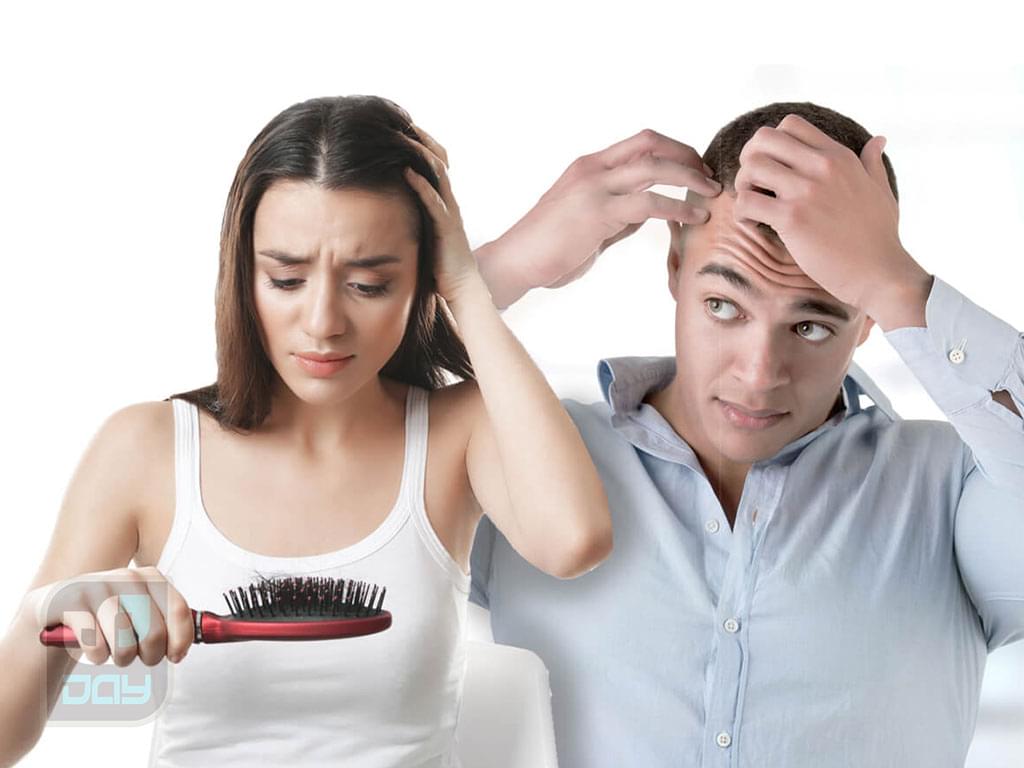 کاشت مو برای آقایان یا بانوان؛ راهنمای کامل انتخاب روش، مراحل انجام و نکات کلیدی 1 کاشت مو برای آقایان یا بانوان