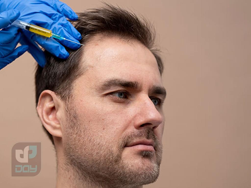 بهترین دکتر کاشت مو در شیراز در کلینیک دی 6 بهترین دکتر کاشت مو در شیراز-6