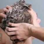 شامپو بعد از کاشت مو عکس شاخص