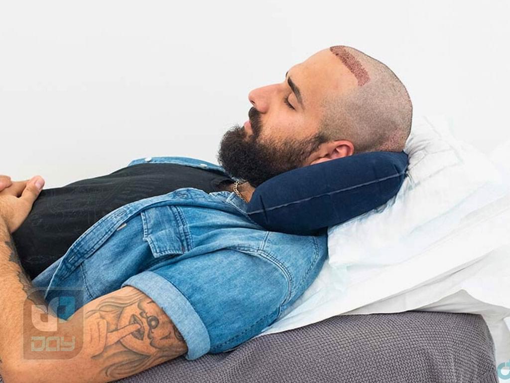 شامپوی مناسب بعد از کاشت مو؛ چه محصولی انتخاب کنیم؟ 4 شامپو بعد از کاشت مو-5