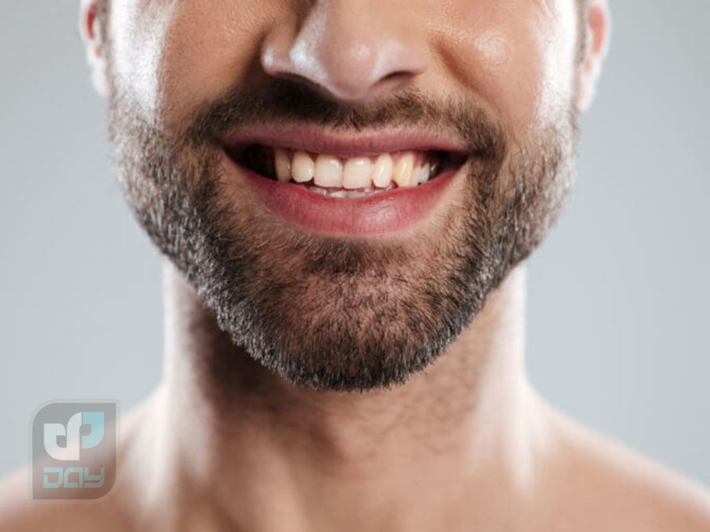 کاشت ریش در شیراز؛ بررسی روشها، هزینه ۱۴۰۴ و مزایا 2 کاشت ریش در شیراز-2