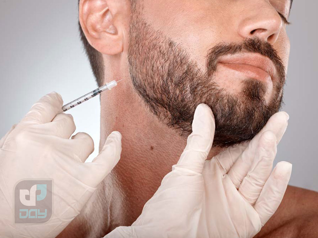 کاشت ریش در شیراز؛ بررسی روشها، هزینه ۱۴۰۴ و مزایا 5 کاشت ریش در شیراز-4