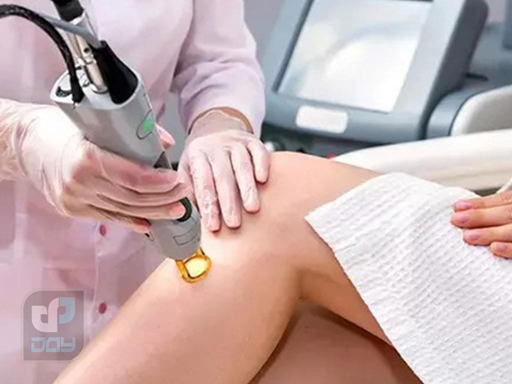 لیزر الکساندرایت یا دایود؟ کدام دستگاه برای حذف موهای زائد بهتر است؟ 5 تفاوت لیزر الکساندرایت و دایود-4