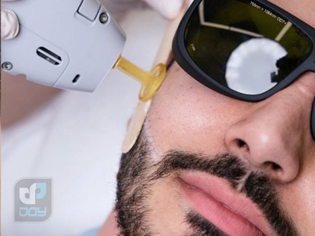 لیزر صورت برای آقایان در شیراز 3 لیزر صورت برای آقایان در شیراز-1