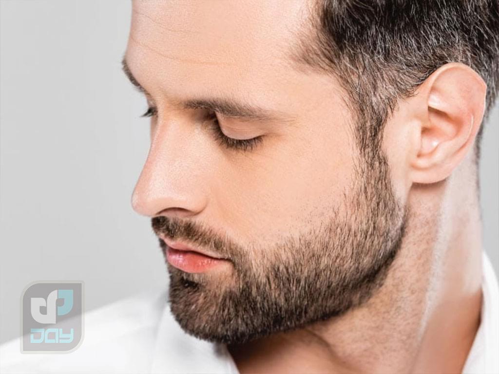 لیزر صورت برای آقایان در شیراز 2 لیزر صورت برای آقایان در شیراز-1