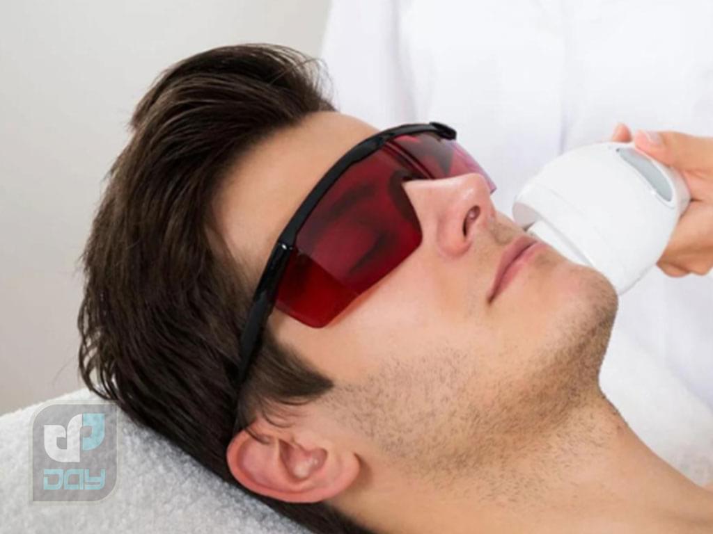 لیزر صورت برای آقایان در شیراز 5 لیزر صورت برای آقایان در شیراز-4