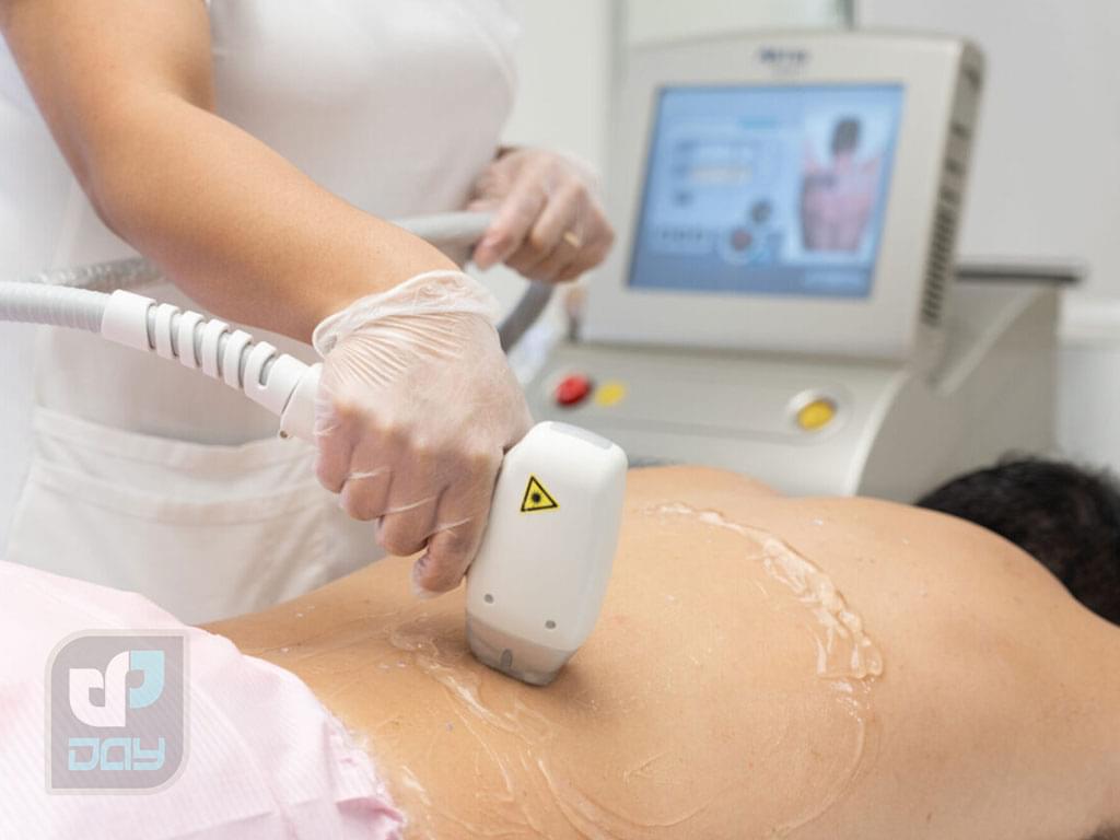 لیزر کل بدن در شیراز؛ هزینه، تعداد جلسات و قیمت 2 لیزر کل بدن در شیراز-2